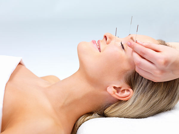 Image of woman with acupuncture needles - link to acupuncture page